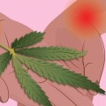 Cannabinoids for Neuropathic Pain Relief: What You Need to Know