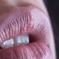 Can CBD be Absorbed Through the Lips?