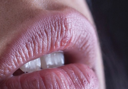 Can CBD be Absorbed Through the Lips?